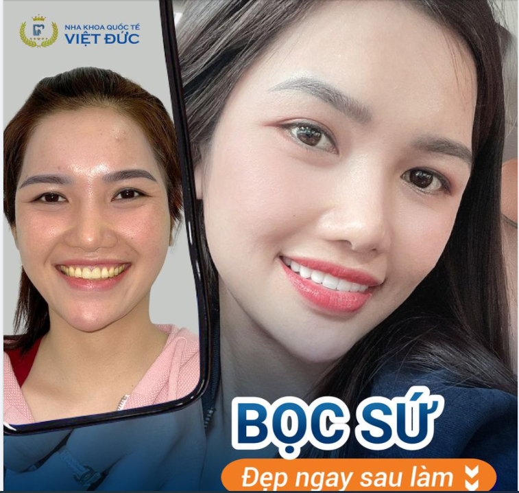 PHÚT GIÂY RẠNG RỠ CỦA NỤ CƯỜI MỚI