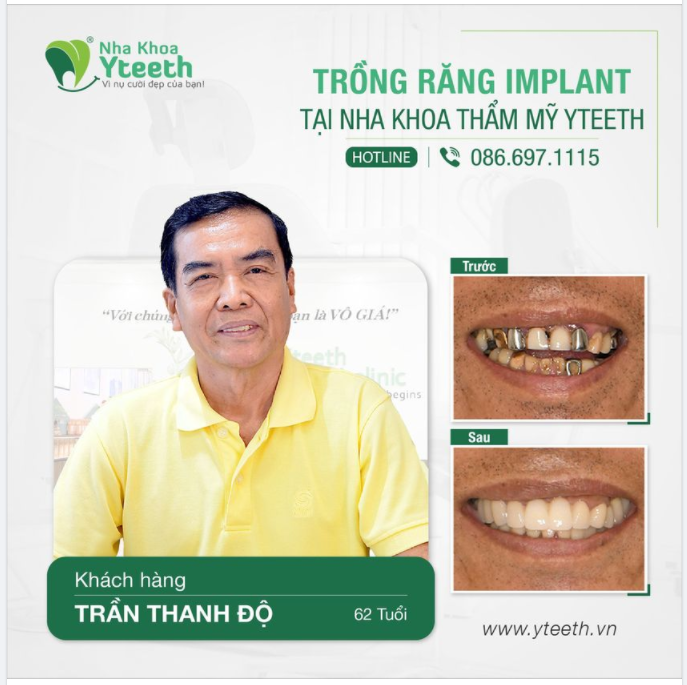 “ Răng chú thế này có cải thiện được không?