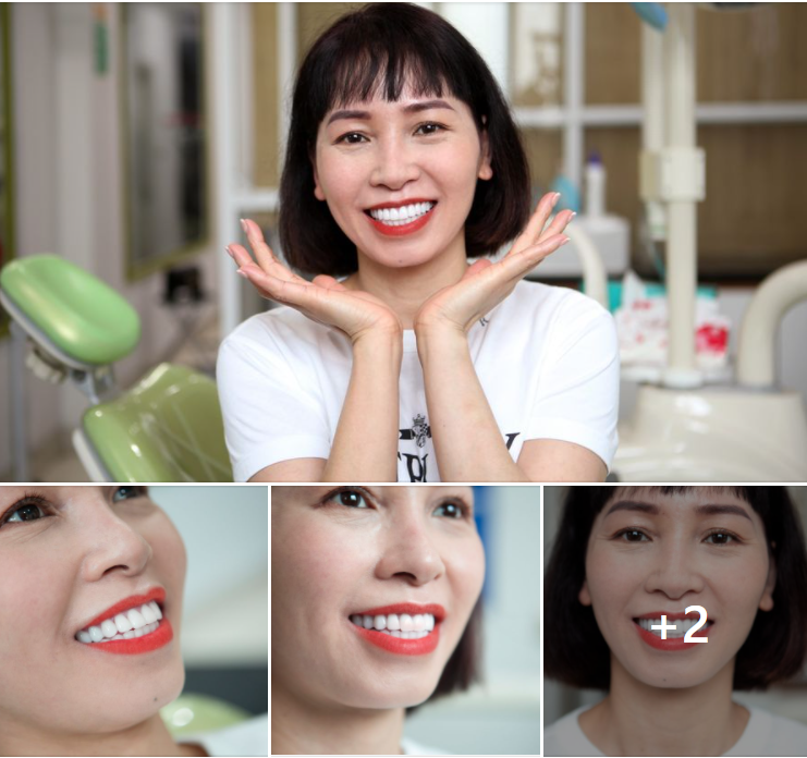 RĂNG SỨ CAO CẤP ORODENT BLEACH TÔN LÊN NỤ CƯỜI HOÀN MỸ CỦA KHÁCH HÀNG