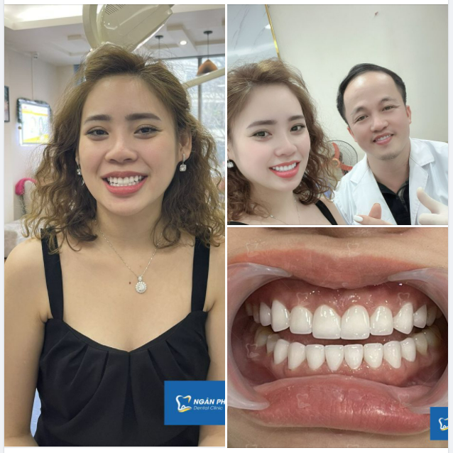 Răng sứ Orodent - chinh phục mọi ánh nhìn