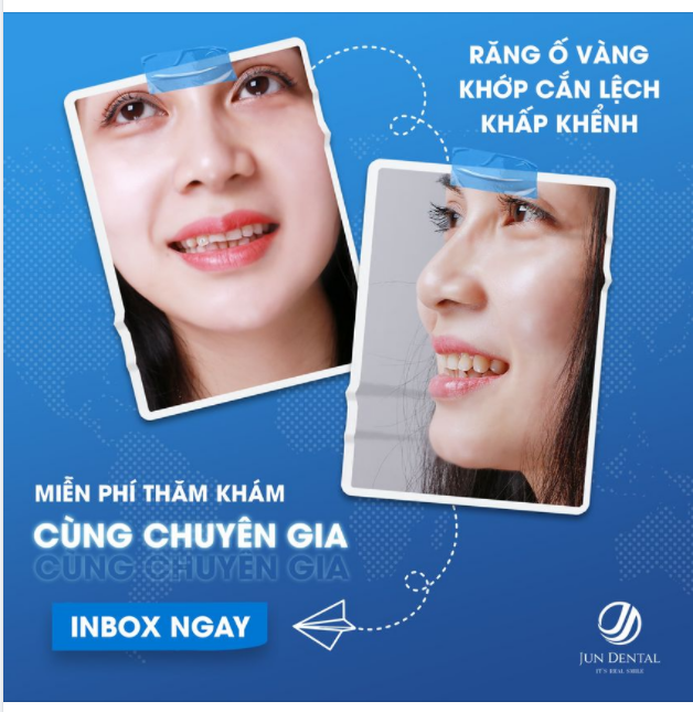 RĂNG SỨ THẨM MỸ, ĐỔI NỤ CƯỜI THAY DIỆN MẠO