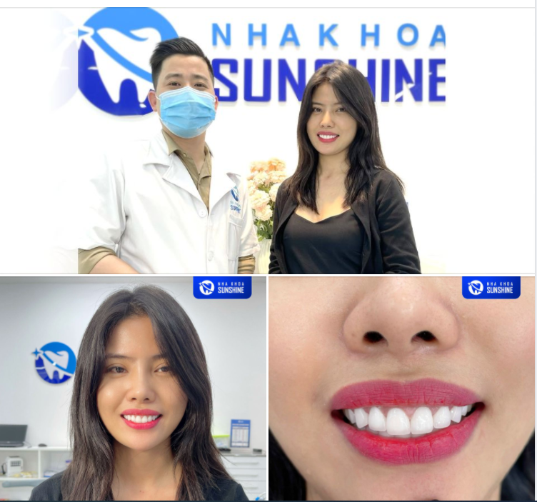 RĂNG SỨ THẨM MỸ - MÓN QUÀ VÔ GIÁ DÀNH TẶNG BẢN THÂN