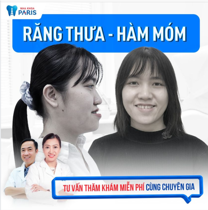 Răng thưa - Hàm móm