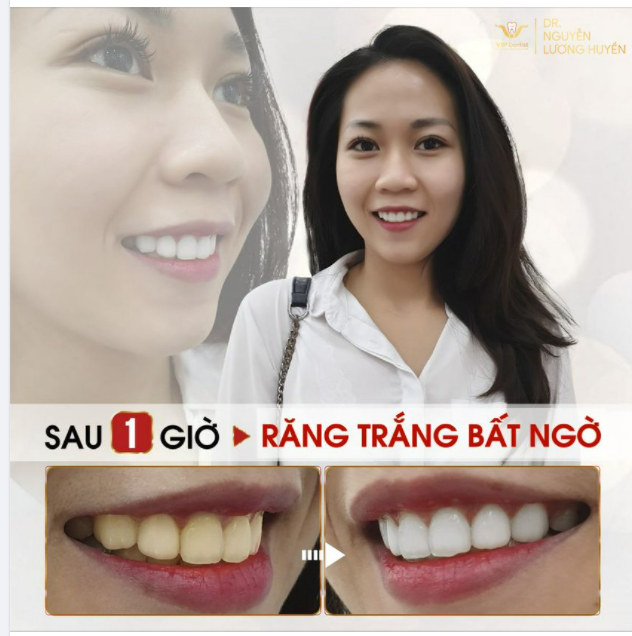 RĂNG TRẮNG CƯỜI XINH - LUNG LINH ĐÓN HÈ