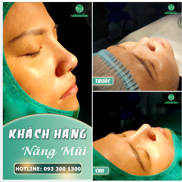 SÁNG CUỐI TUẦN - CÙNG NGẮM NHÌN MỘT DÁNG MŨI ĐẸP