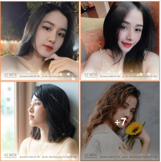 SLINE TỰ NHIÊN - Khi bạn thích nâng mũi nhẹ nhàng sương sương