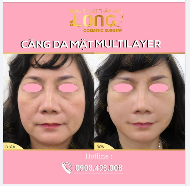 SỢ GÌ LÃO HÓA - TRẺ HÓA LÀN DA