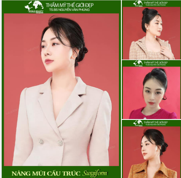 Sở hữu góc nghiêng chuẩn TỶ LỆ VÀNG giúp dung nhan Hotgirl trà sữa ngày một nhuận sắc sau 3 năm nâng mũi