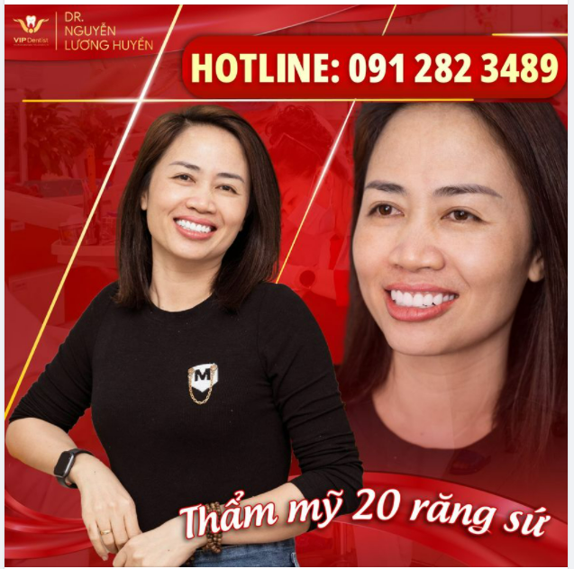 SỨ CHUẨN ĐỨC KIẾN TẠO ĐƯỜNG CƯỜI HOÀN MỸ