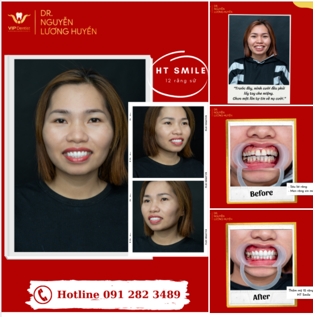 SỰ TỰ TIN MANG TÊN HT SMILE