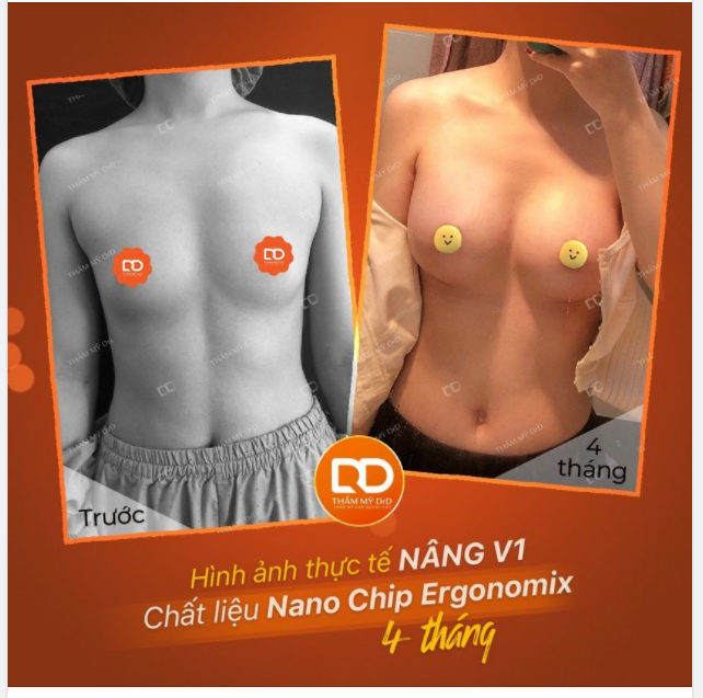 Tại sao DrD luôn show các hình ảnh thực tế trước sau của khách hàng thay vì những hình ảnh nghệ thuật