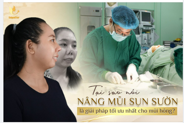 Tại sao nói nâng mũi sụn sườn là giải pháp tối ưu nhất cho mũi hỏng
