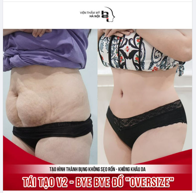 Tái tạo V2 - Bye bye đồ Oversize