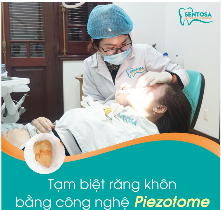 TẠM BIỆT RĂNG KHÔN BẰNG CÔNG NGHỆ PIEZOTOME
