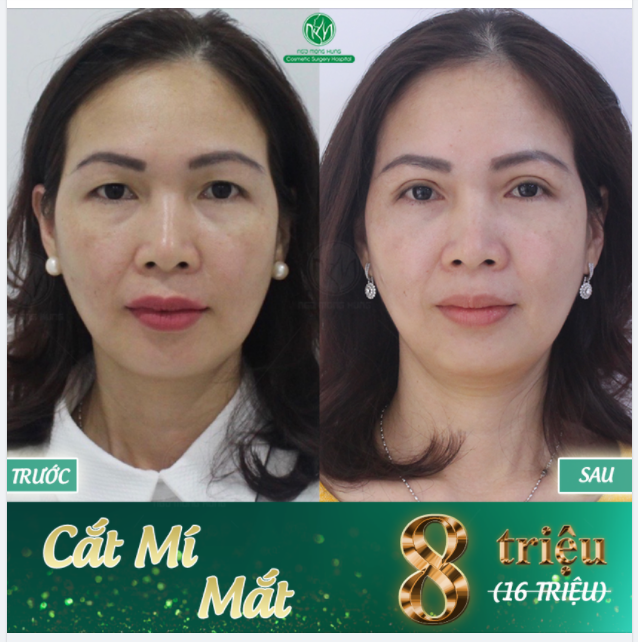 TÂN TRANG ĐÔI MẮT - ĐÓN LỄ RỘN RÀNG