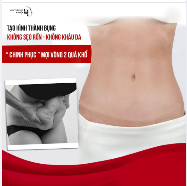 TẠO HÌNH THÀNH BỤNG KHÔNG SẸO RỐN - KHÔNG KHÂU DA