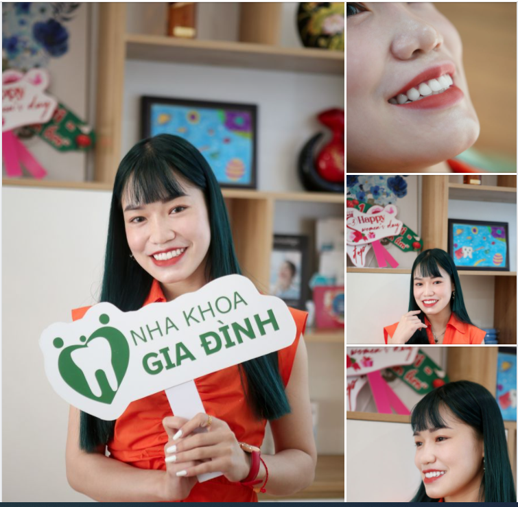 THẨM MỸ RĂNG - BÍ QUYẾT TRẺ HÓA NỤ CƯỜI