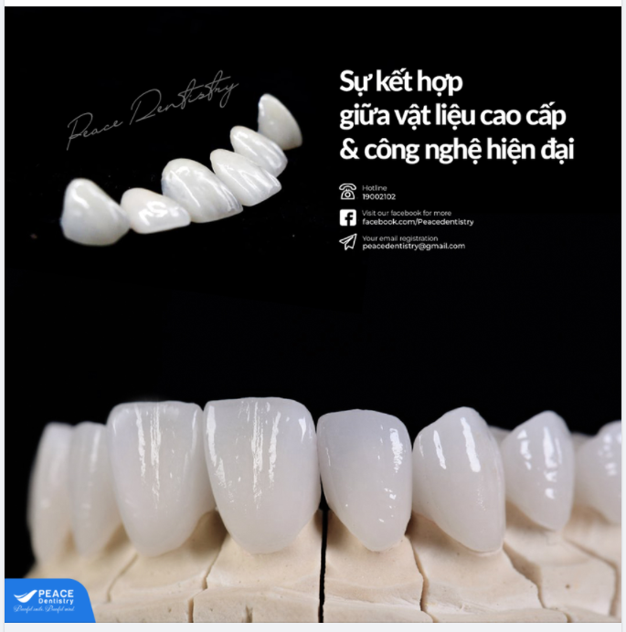 THẨM MỸ RĂNG SỨ: bác sĩ giỏi là cực kỳ quan trọng nhưng như vậy là chưa đủ!
