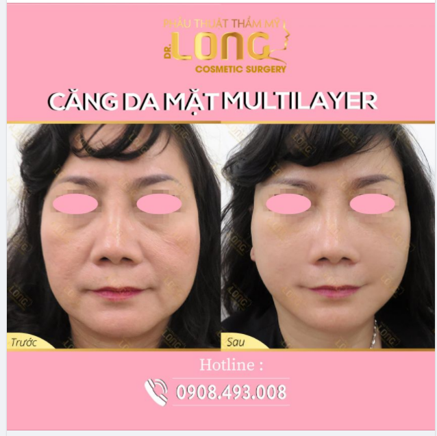 THANH XUÂN NHƯ MỘT LY TRÀ MUỐN TRẺ HÓA KHÔNG GIÀ THÌ PHẢI LÀM SAO