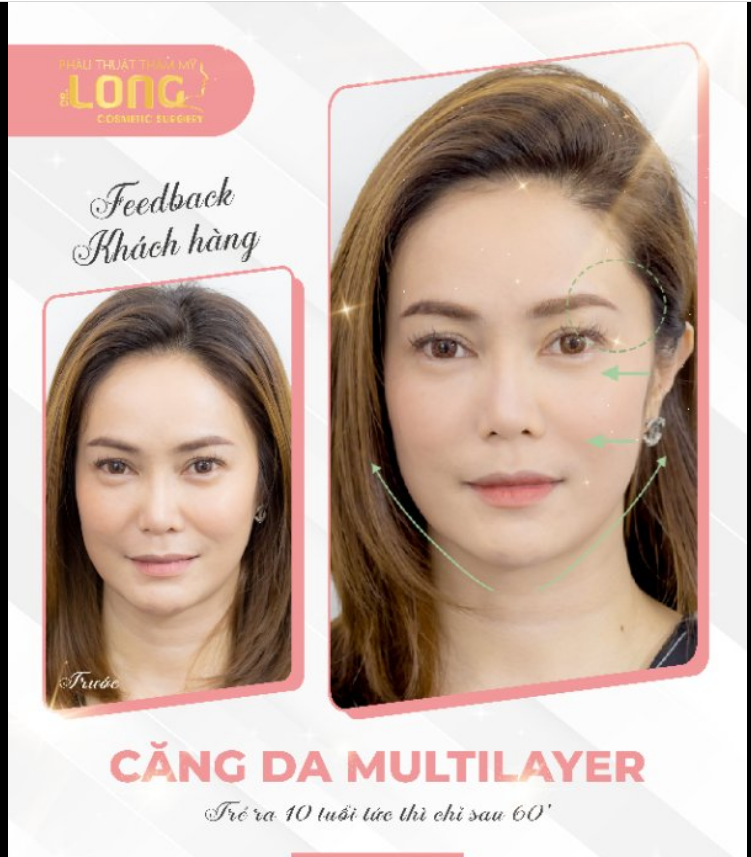 THAY ÁO MỚI CHO LÀN DA