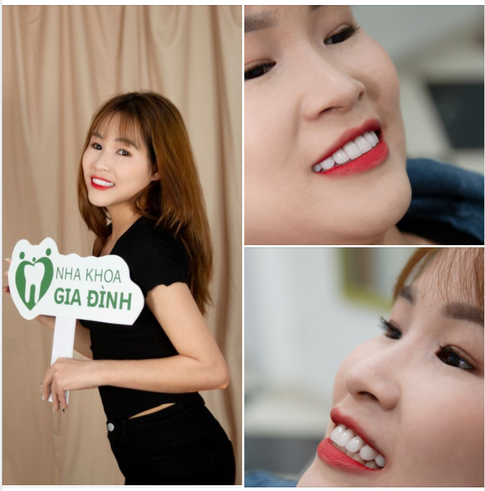 THAY ĐỔI NỤ CƯỜI - GƯƠNG MẶT BỪNG SÁNG