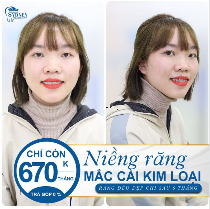 THAY ĐỔI NỤ CƯỜI - NÂNG TẦM NHAN SẮC