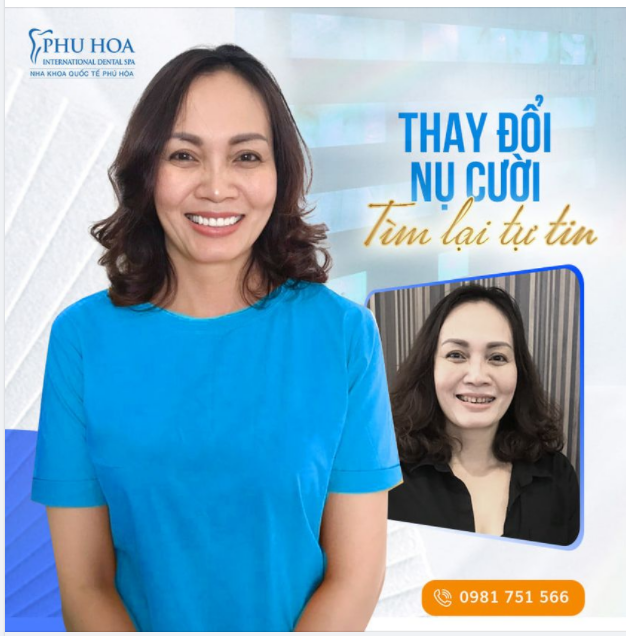 THAY ĐỔI NỤ CƯỜI, TÌM LẠI TỰ TIN