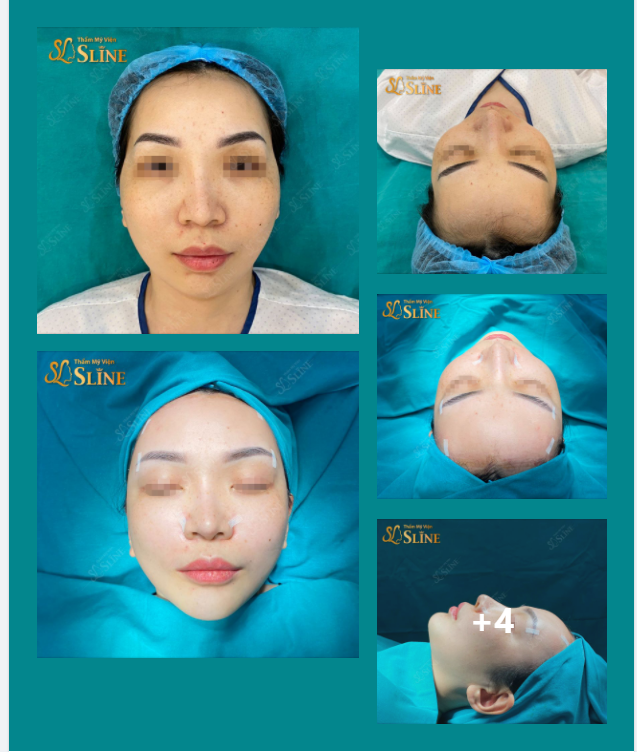 Thế nào là 1 khuôn mặt Đẹp