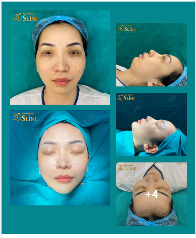 Thế nào là một khuôn mặt Đẹp