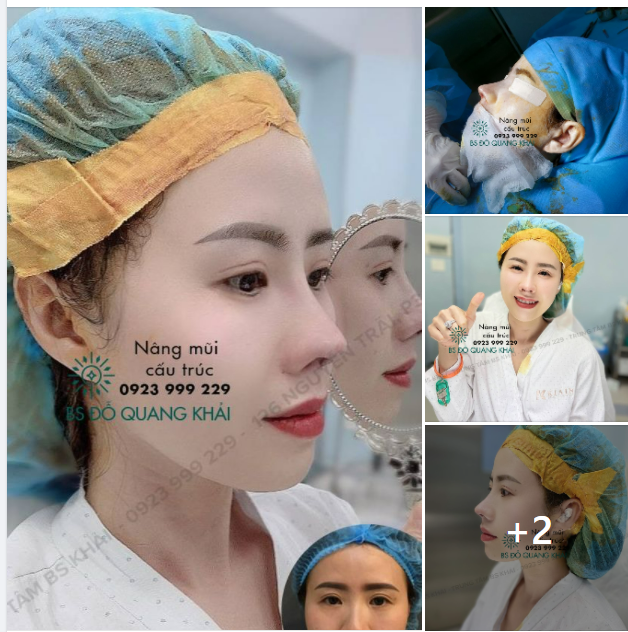 Thì ra mua xuân hoa nở là vì em ! DÁNG MŨI CẤU TRÚC DR.KHẢI - KIỆT TÁC THẨM MỸ 4.0