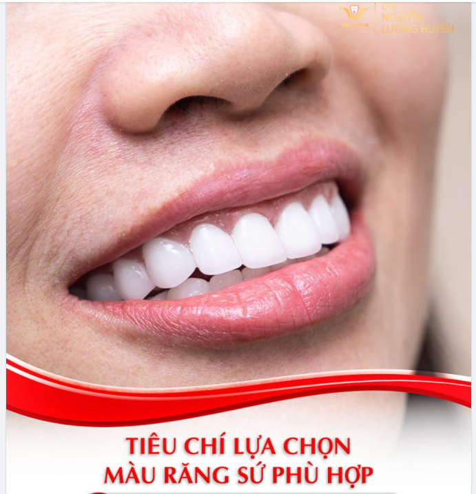 TIÊU CHÍ LỰA CHỌN MÀU RĂNG SỨ PHÙ HỢP