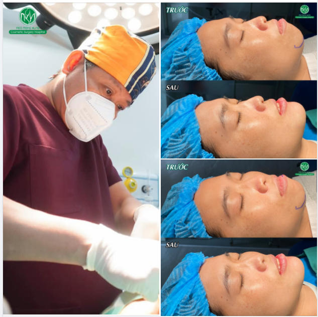TIỂU PHẪU NHỎ NHƯNG MANG LẠI THAY ĐỔI LỚN