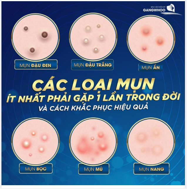 7. Các câu hỏi thường gặp