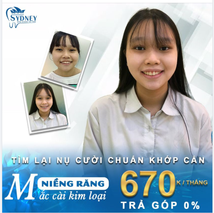 TÌM LẠI NỤ CƯỜI CHUẨN KHỚP CẮN CHO CON BỐ MẸ NHÉ 