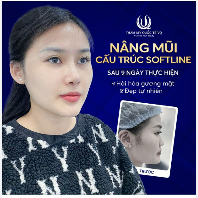 Tôn nét xinh - Bật thần thái