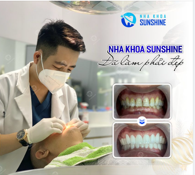 TRẮNG SÁNG ĐỀU ĐẶN, ĐÁNH BAY MỌI KHUYẾT ĐIỂM VỀ RĂNG