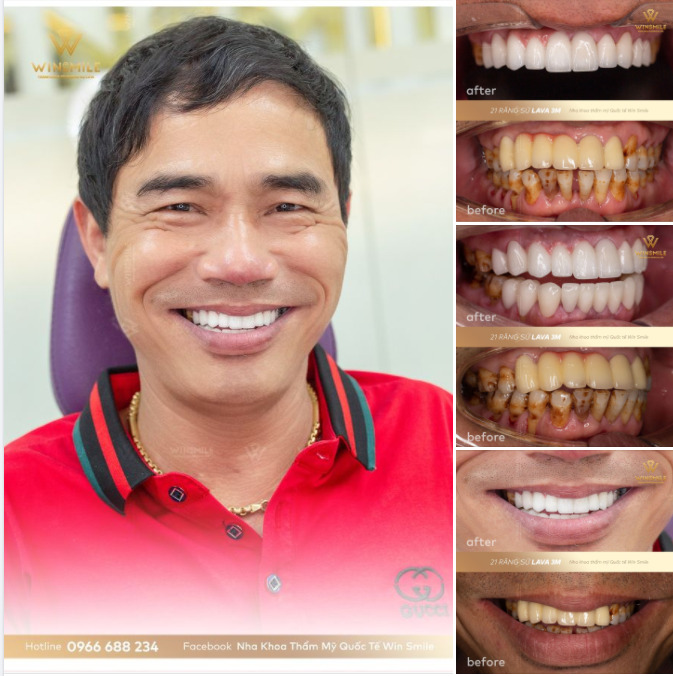 TRAO SỨC KHỎE, GỬI YÊU THƯƠNG ĐẾN NHỮNG NGƯỜI QUAN TRỌNG CÙNG LAVA 3M