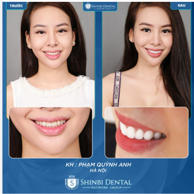 TRAO YÊU THƯƠNG TẶNG NỤ CƯỜI NHIỀU HƠN GIỮA MÙA LOA KÈN NỞ