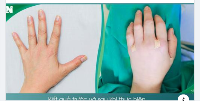 Trẻ hóa bàn tay