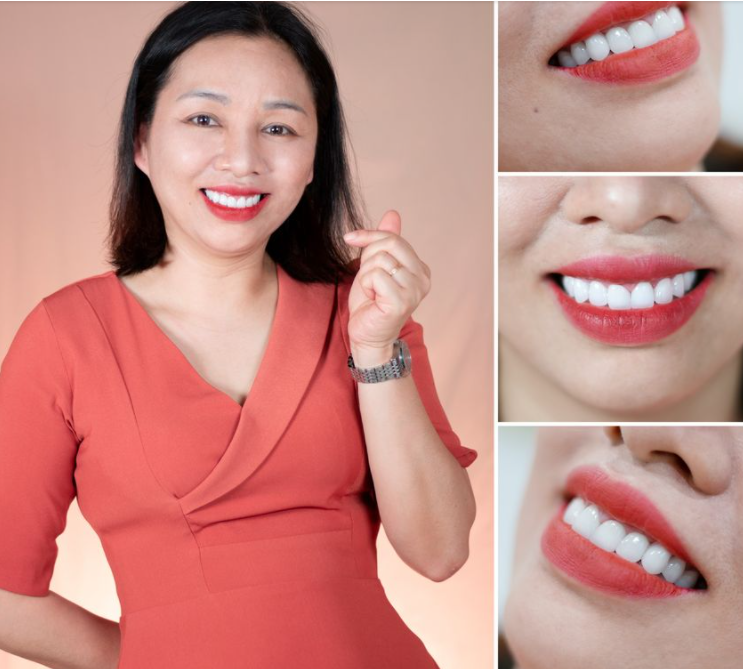 TRẺ HƠN CẢ CHỤC TUỔI KHI LÀM RĂNG SỨ THẨM MỸ