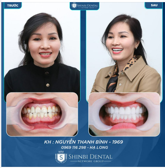 TRỌN VẸN TRONG TỪNG KHOẢNH KHẮC