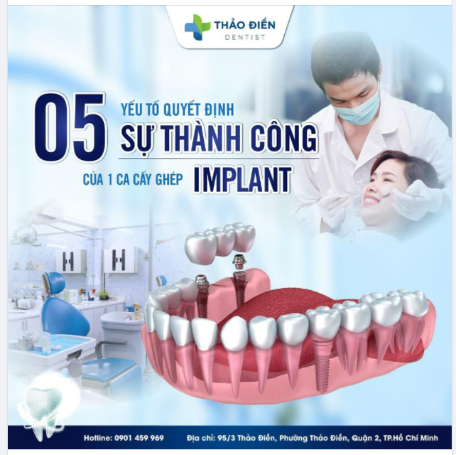 TRỒNG RĂNG IMPLANT 5 YẾU TỐ QUYẾT ĐỊNH SỰ THÀNH CÔNG