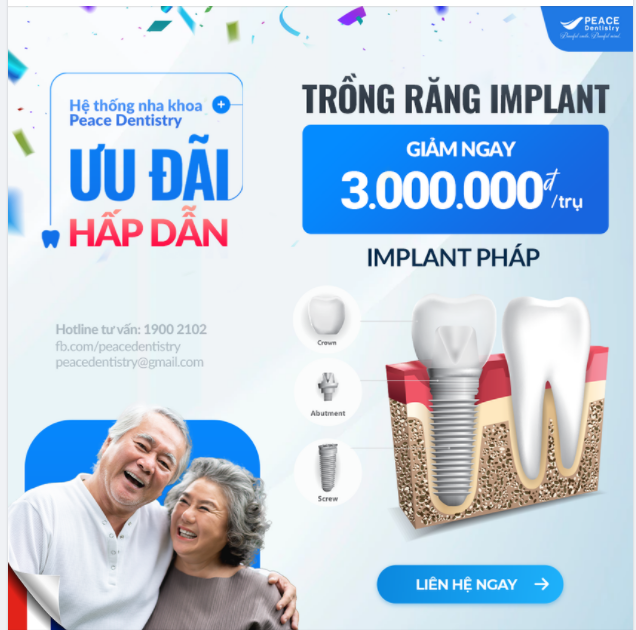 TRỒNG RĂNG IMPLANT VỚI BÁC SĨ CHUYÊN GIA NỔI TIẾNG VÀ NHẬN ƯU ĐÃI ĐẶC BIỆT HẤP DẪN TỪ PEACE DENTISTRY