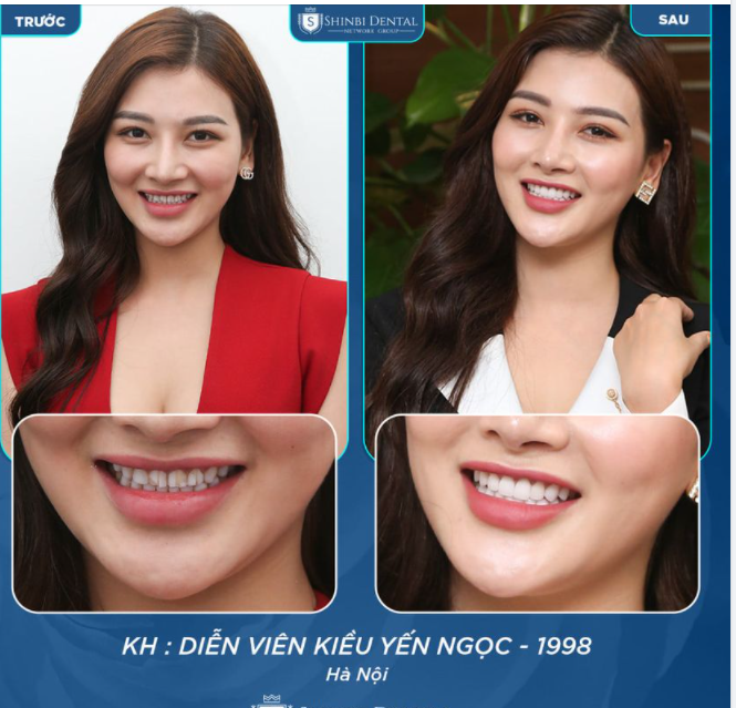 TỰ TIN VÀO NỤ CƯỜI CỦA MÌNH CHÍNH LÀ BÔNG HOA ĐẸP NHẤT