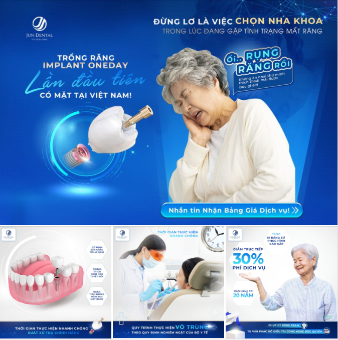 Ưu điểm vượt trội của công nghệ Implant OneDay tiên phong kỷ nguyên trồng răng rút ngắn thời gian đem lại: