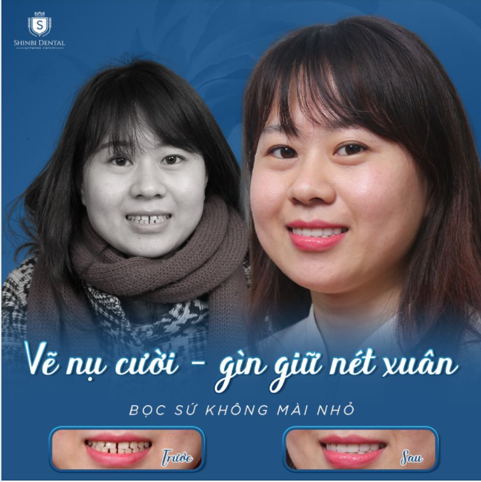VẼ NỤ CƯỜI - GÌN GIỮ NÉT XUÂN