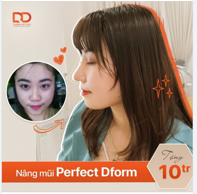 Vì mình quá thích dáng mũi này rồi, phải làm sao phải làm sao Vậy thì thực hiện ngay khi đang có ƯU ĐÃI THÔI