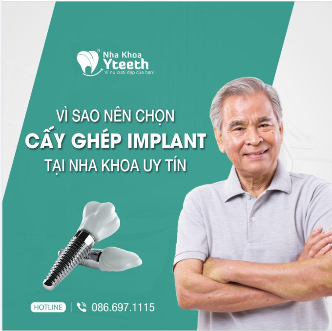 Vì Sao Nên Chọn Cấy Ghép Implant tại nha khoa uy tín