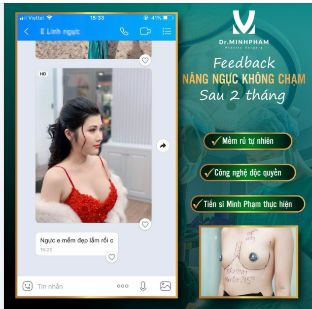 VÒNG 1 KHÍT KHE, MỀM RỦ TỰ NHIÊN SAU 2 THÁNG