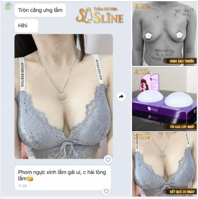 VÒNG 1 SAU NÂNG CHUẨN 5 SAO